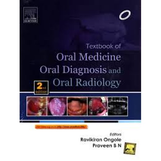 Textbook Of Oral Medicine Oral Diagnosis And Oral Radiology 2nd Edition By Ravikiran Ongole